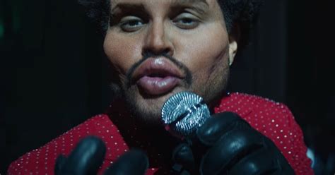 The Weeknd S True Face Is Finally Revealed After Plas
