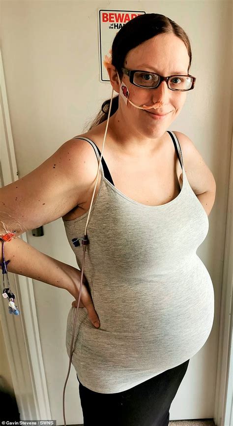 Mother Lost 7st 10lb While Pregnant After Extreme Morning Sickness Made Her Vomit 50 Times A Day