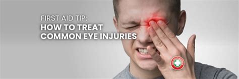 First Aid Tip 4 Most Common Eye Injuries And How To Treat Them The