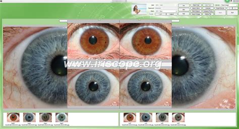 Iridology Cameras Working Principle Advantages Who Needs Them And