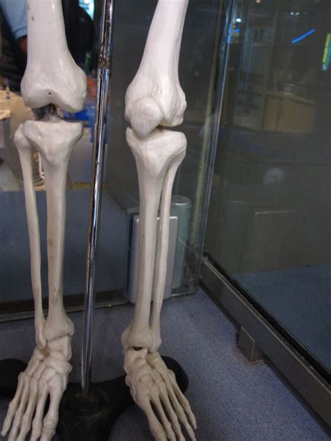 Real Human Leg Bones Take At Look At These X Rays