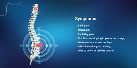 Spinal Cord Disorders Symptoms Causes And Treatment