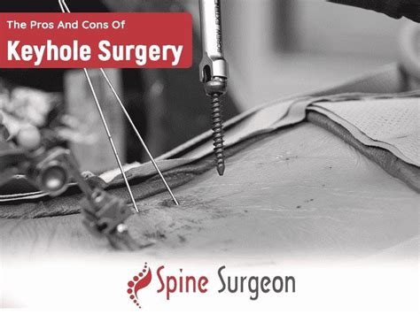 The Pros And Cons Of Keyhole Surgery Spine Surgeon