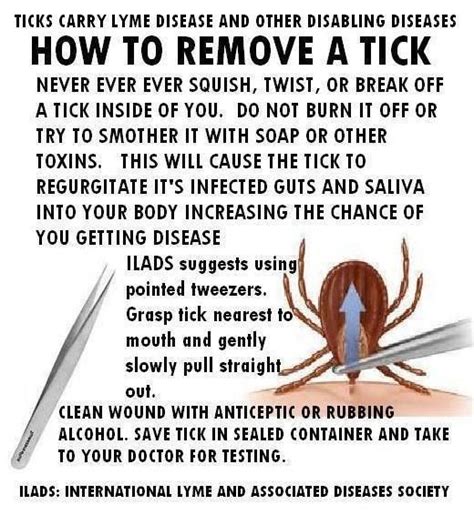 How To Remove Tick On Child Howtormeov