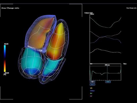 Cardiology Clinical Segment Ultrasound Canon Medical Systems Usa