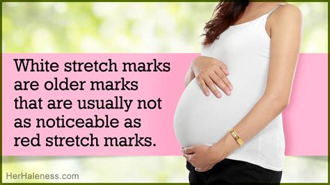 Difference Between Red And White Stretch Marks Wellness Keen