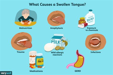 swollen tongue causes and treatment