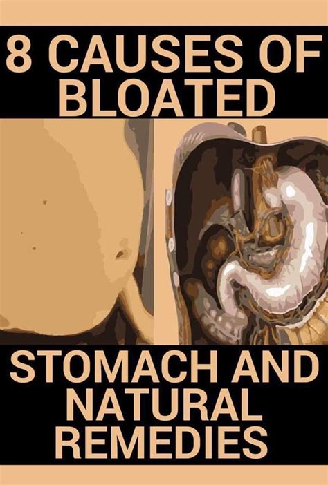 8 Causes Of Bloated Stomach And Natural Remedies Medicine Stomach
