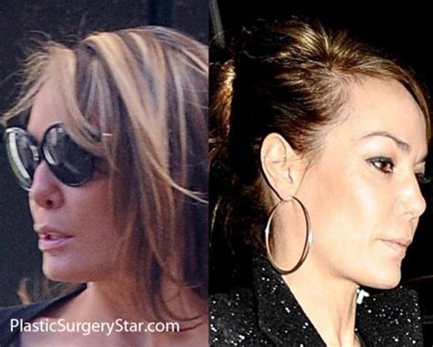 Celebrity Boob Jobs Tara Palmer Tomkinson Plastic Surgery Before And After Botox And Nose Jobs