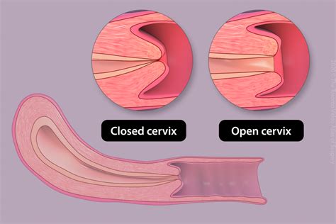 Dilated Cervix Diagram