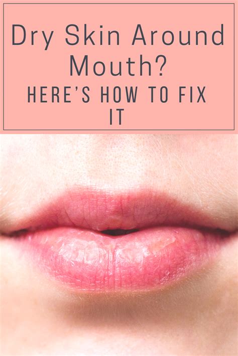Fix Dry Skin Around Mouth With These Tips Skincare Dryskincare