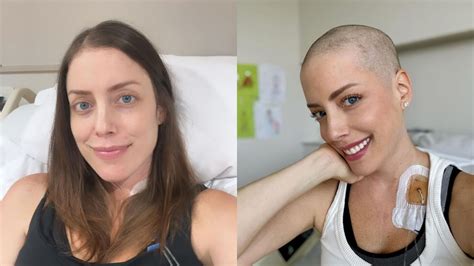 Fabiana Justus Mostra Fotos Após Raspar O Cabelo Em Tratamento Contra O Câncer Cnn Brasil