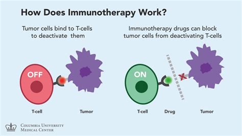 Fda Approved Immunotherapy For Melanoma Biopharma Peg