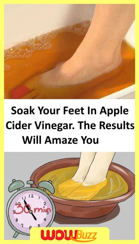 Soak Your Feet In Vinegar Once A Week And You Will See How All Your