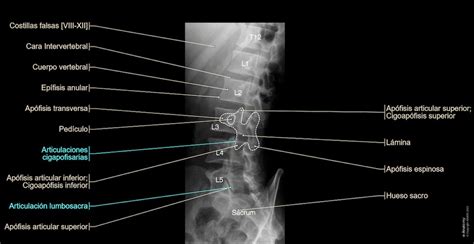 Columna Vertebral Radiografía Estándar Anatomía Normal E Anatomy