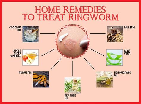 Best Home Remedies For Ringworm