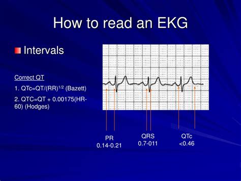 Ppt How To Read An Ekg Powerpoint Presentation Free Download Id