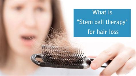 What Is Stem Cell Therapy For Hair Loss Steps In Prp Treatment