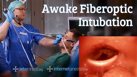 Awake Fiberoptic Intubation Youtube