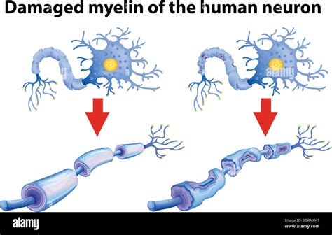 Neurona Humana Imágenes Vectoriales De Stock Alamy