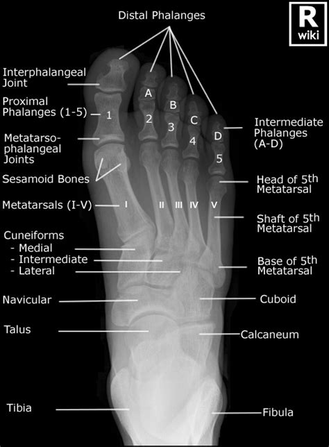 Foot Radiographic Anatomy Wikiradiography
