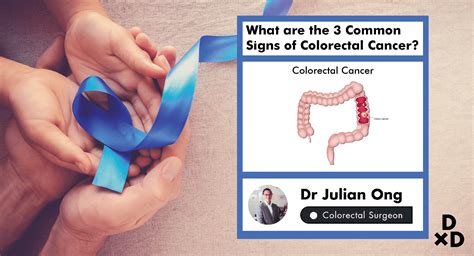 What Is The First Sign Of Rectal Cancer 15 Warning Signs Of Colon