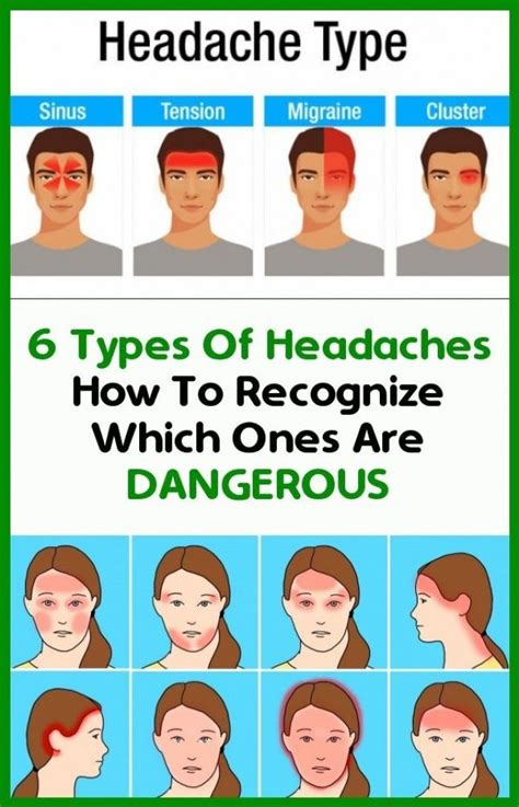 Headache Types Chart