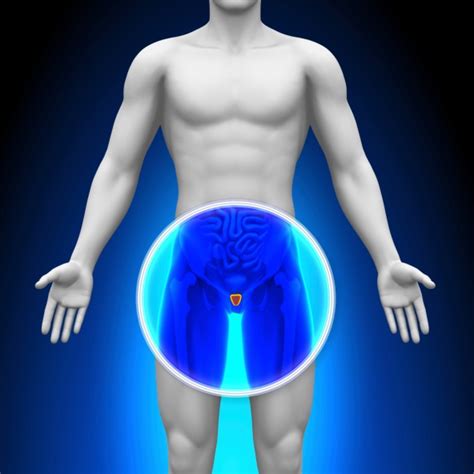 Find out about treatments, such as nephrectomy and immunotherapy. Cryotherapy Is a Viable Choice for High-Grade Prostate ...