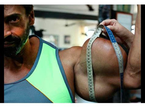 El Parroquiano Asi Quedo El Hulk Brasileño Tras Inyectarse Aceite Desfigurado
