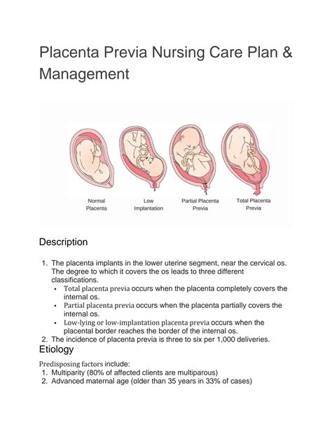 Solution Placenta Previa Nursing Care Plan And Management Studypool