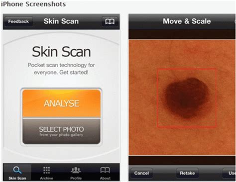 Dermatology Apps Applications Including Skin Scan