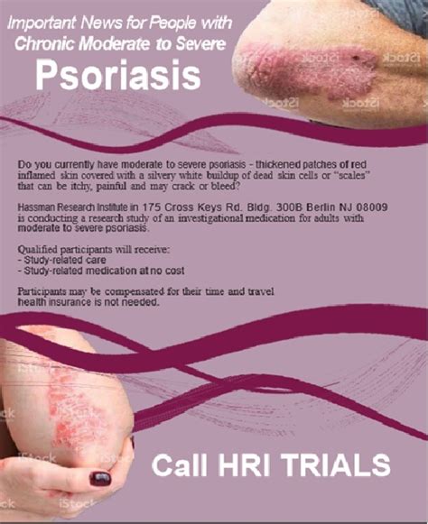 Psoriasis Berlin Nj Clinical Trial 36999