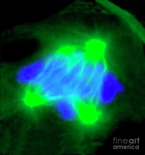 Abnormal Mitosis Photograph By Pascal Goetgheluck Science Photo Library