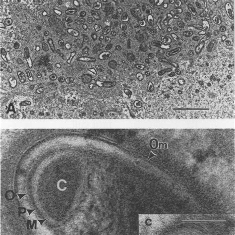 Pdf In Vivo Endogenous Spore Formation By Coxiella Burnetii In Q