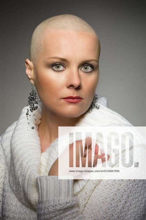 Beautiful Middle Age Woman Cancer Patient Without Hair Model Released Symbolfoto