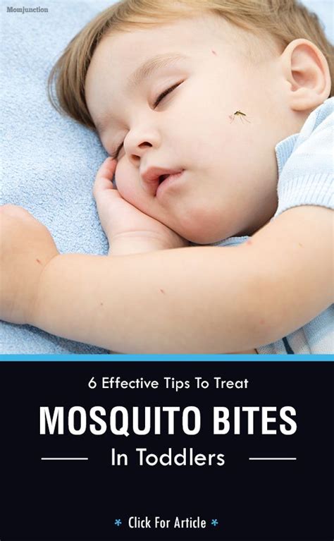 6 Effective Tips To Treat Mosquito Bites In Toddlers Toddler Sleep