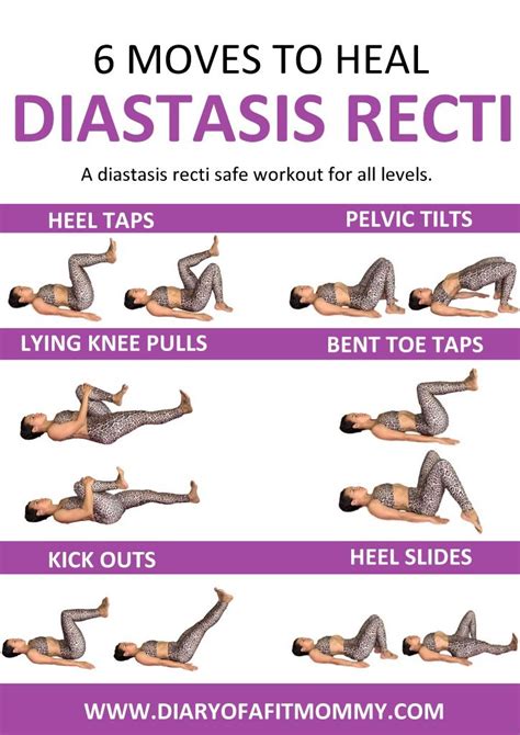 Diastasis Recti Exercises Printable Place One Hand In The Center Of The
