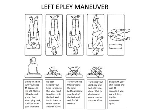 Handout Visualizing The Epley Maneuver Epley Maneuver Vertigo Sexiz Pix