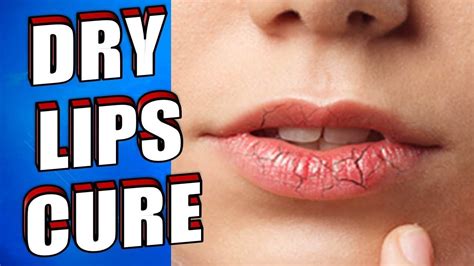 Dry Lips Fast Cure Best Natural Treatment For Dry Lips Using A Lip