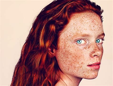 Photographer Celebrates The Unique Beauty Of Freckled People Through