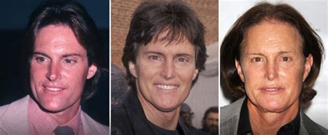 The Worst Male Celebrity Plastic Surgeries Ever Faculty Of Medicine