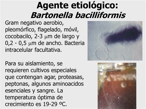 Ppt Bartonelosis Humana Por Bartonella Bacilliformis Powerpoint