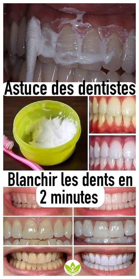 Astuce Des Dentistes Pour Blanchir Les Dents En 2 Minutes Blanchir