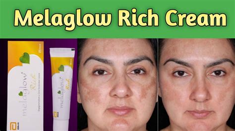 Melaglow Rich Cream Uses And Side Effects👍 Youtube