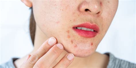 Red Spots On Skin Causes Treatment And When To Worry