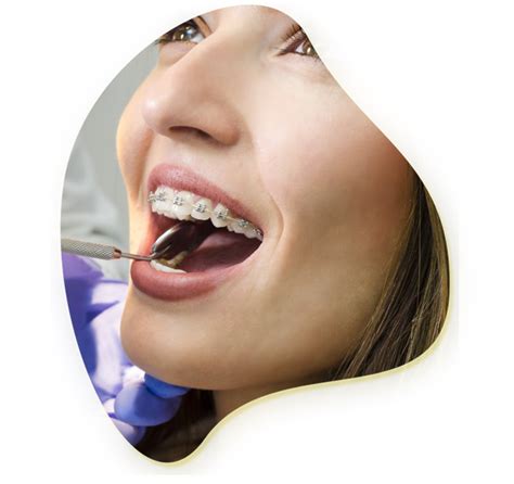 Dental Braces In Rockport Tx Best Braces Dentists In Rockport