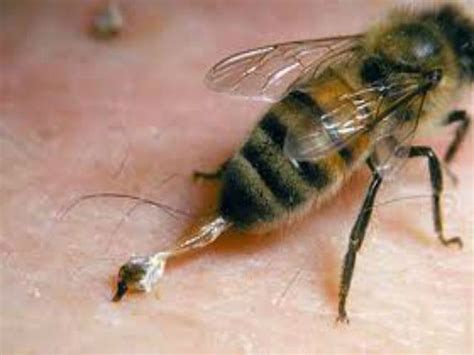 Health Bee Sting Therapy Can Save Your Life