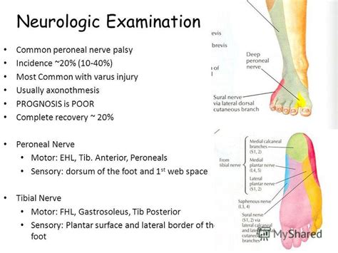 Презентация на тему Knee Dislocation Kaznmu 2 топ Anatomy