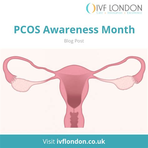Pcos Polycystic Ovary Syndrome Ivf London