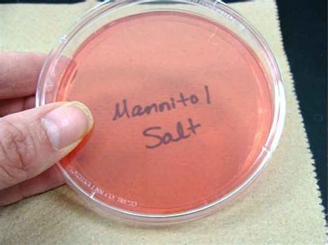 Mannitol Salt Agar Uninoculated